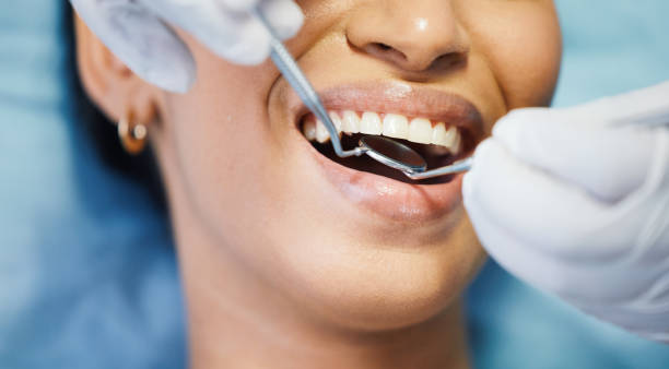 Best Emergency Dental Care for Broken or Chipped Teeth in USA